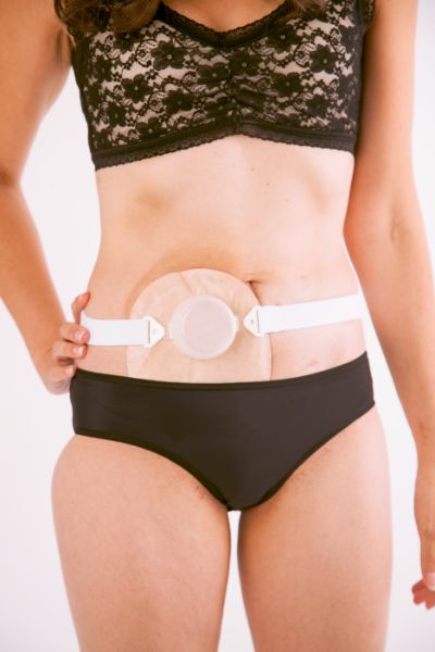 THE STOMA CUP A must have product! We cannot believe how good this product is. Allows you to have a bath or shower without your bag. Also great when changing bags, a third hand to help you. You'll never know how you did without one. The Stoma Cup attaches easily with an Ostomy belt (not included, but available free on prescription in the UK). The Stoma Cup gives you a third hand, holding a piece of absorbent material over your stoma to catch any unintended flow. You'll now experience the freedom and convenience of having both hands free to clean up and attach your new appliance. When bathing or showering it feels like you don't have a stoma, no more wet bags. Made from high quality moulded plastic, can be used over and over again.